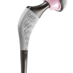 SPS Evolution - Custom Hip™